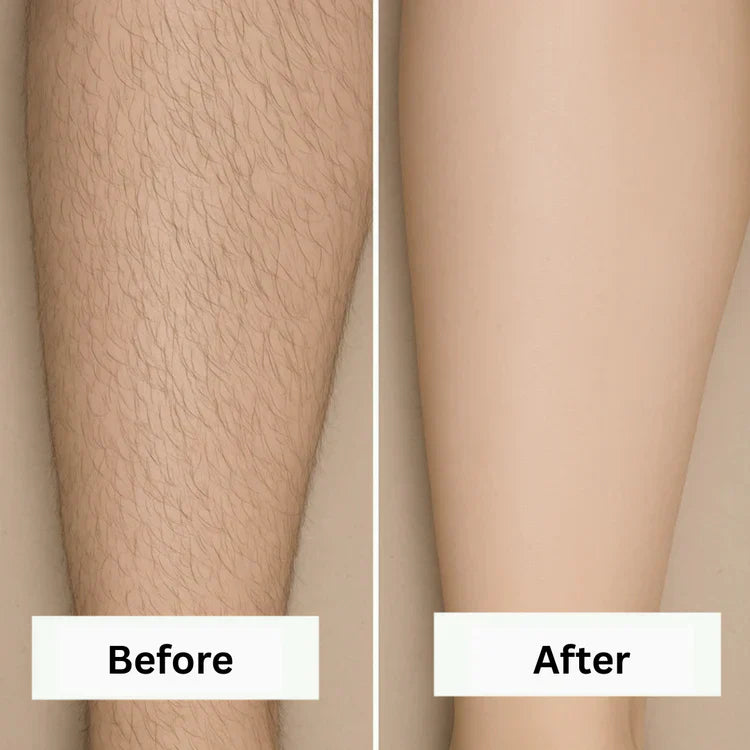 Removely IPL 3+ (Try & Buy Spain)