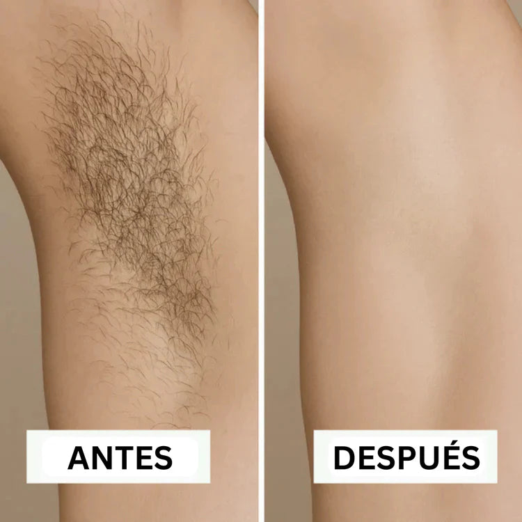 Removely IPL 3+ (Try & Buy Spain)