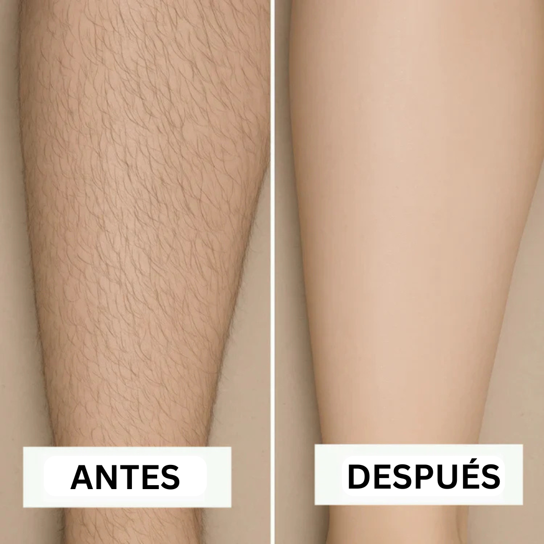 Try & Buy - Removely IPL 5+